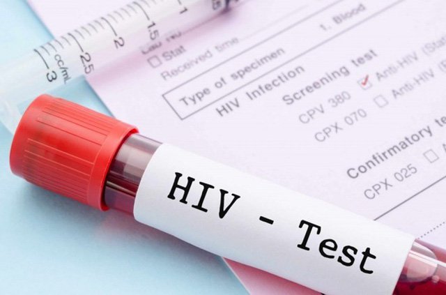 Có mấy giai đoạn diễn biến tự nhiên của nhiễm HIV?